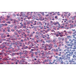 Stathmin 1 (STMN1) Antibody