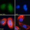 Tigger Transposable Element-Derived Protein 1 (TIGD1) Antibody