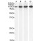 26S Proteasome Non-ATPase Regulatory Subunit 2 (PSMD2) Antibody