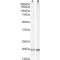 Ubiquitin Conjugating Enzyme E2C (UBE2C) Antibody