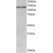 abx430631 staining (1 µg/ml) of Jurkat lysate (RIPA buffer, 30 µg total protein per lane). Primary incubated for 1 hour. Detected by chemiluminescence.