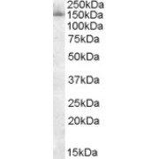 abx430634 staining (0.1 µg/ml) of nuclear lysate from HeLa cells (RIPA buffer, 30 µg total protein per lane). Detected by chemiluminescence.