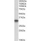 NADH-Cytochrome B5 Reductase 3 (CYB5R3) Antibody