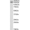 Ribonuclease III, Nuclear (RNASEN) Antibody