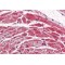 Phosphatidylinositol-4,5-Bisphosphate 3-Kinase Catalytic Subunit Alpha Isoform (PIK3CA) Antibody