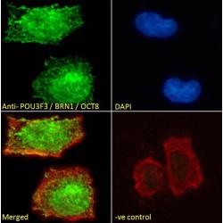 POU Class 3 Homeobox 3 (POU3F3) Antibody