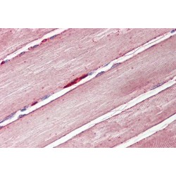 Glucose Transporter 4 / GLUT4 (SLC2A4) Antibody