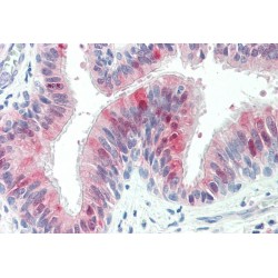 HIP14L Antibody