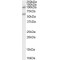 Caspase Recruitment Domain-Containing Protein 15 (CARD15) Antibody