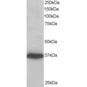 abx430675 staining (0.2 µg/ml) of A431 lysate (RIPA buffer, 35 µg total protein per lane). Primary incubated for 1 hour. Detected by chemiluminescence.