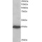 PDZ And LIM Domain 4 (PDLIM4) Antibody