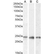 abx430679 (0.1 µg/ml) staining of Human Kidney (A), Liver (B) and Testes (C) lysate (35 µg protein in RIPA buffer). Detected by chemiluminescence.