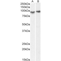 Centaurin-Beta-2 (CENTB2) Antibody
