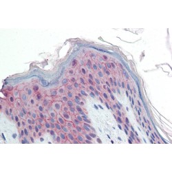 Desumoylating Isopeptidase 2 (PPPDE1) Antibody