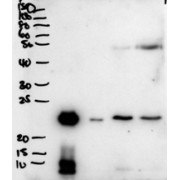 abx430704 (2 µg/ml) staining of secretions from Human primary airway cells in culture (lanes 1 and 2), and in Human Bronchoalveolar Lavage fluid (lanes 3 and 4) . Data obtained from Dr. C Bingle, AURM, University of Sheffield, UK. Primary incubation was 1 hour. Detected by chemiluminescence.