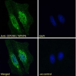 Centrosomal Protein 290 kDa (CEP290) Antibody