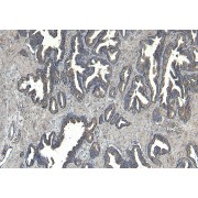 abx430707 (8 µg/ml) staining of paraffin embedded Human Prostate. Heat induced antigen retrieval with citrate buffer pH 6, HRP-staining.