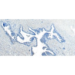 Centrosomal Protein 290 kDa (CEP290) Antibody