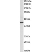 abx430711 (0.3 µg/ml) staining of Human Colorectal cancer lysate (35 µg protein in RIPA buffer). Primary incubation was 1 hour. Detected by chemiluminescence.