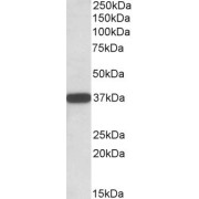 abx430712 (0.01 µg/ml) staining of Human Umbilical Cord lysate (35 µg protein in RIPA buffer). Primary incubation was 1 hour. Detected by chemiluminescence.