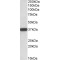 NADH-Cytochrome B5 Reductase 3 (CYB5R3) Antibody