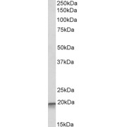 abx430716 (0.1 µg/ml) staining of K562 lysate (35 µg protein in RIPA buffer). Detected by chemiluminescence.