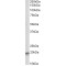 Eukaryotic Translation Elongation Factor 1 Epsilon 1 (EEF1E1) Antibody