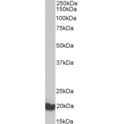 Eukaryotic Translation Elongation Factor 1 Epsilon 1 (EEF1E1) Antibody