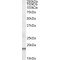 High Mobility Group Protein HMGI-C (HMGA2) Antibody