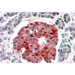 Potassium Voltage-Gated Channel Subfamily J Member 11 (KCNJ11) Antibody