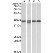 abx430727 (0.3 µg/ml) staining of Daudi (A), Jurkat (B), K562 (C) and Molt4 (D) lysates (35 µg protein in RIPA buffer). Primary incubation was 1 hour. Detected by chemiluminescence.