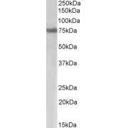 abx430729 ((2 µg/ml) staining of Mouse Skeletal Muscle lysate (35 µg protein in RIPA buffer). Primary incubation was 1 hour. Detected by chemiluminescence.