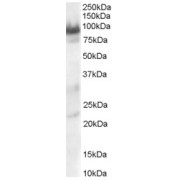 abx430732 staining (0.3 µg/ml) of Human Heart lysate (RIPA buffer, 30 µg total protein per lane). Primary incubated for 1 hour. Detected by chemiluminescence.