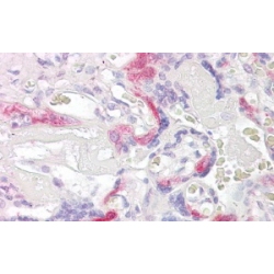 IPL Antibody