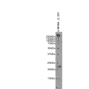 WB analysis using abx430733 (2 µg/ml)of MDA-MB-231 cell lysate.