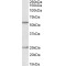 POU Domain, Class 2, Transcription Factor 2 / OCT2 (POU2F2) Antibody