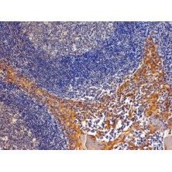 Ran-Binding Protein 8 (RANBP8) Antibody