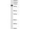 Scavenger Receptor Class B Member 1 (SCARB1) Antibody