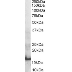 SH2 Domain Containing 1A (SH2D1A) Antibody