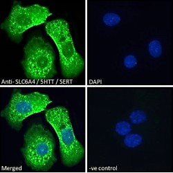 Sodium-Dependent Serotonin Transporter (SLC6A4) Antibody