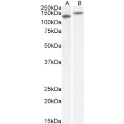 Sodium-Dependent Serotonin Transporter (SLC6A4) Antibody