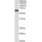 Solute Carrier Family 7 Member 6 (SLC7A6) Antibody