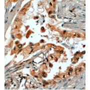 abx430763 (4 µg/ml) staining of paraffin embedded Human Prostate. Steamed antigen retrieval with citrate buffer pH 6, HRP-staining.