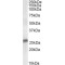 Steroid 5 Alpha Reductase 2 (SRD5A2) Antibody