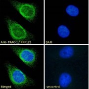 T-Cell RING Activation Protein 1 (TRAC-1) Antibody