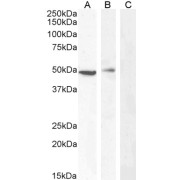 abx430775 (0.5 µg/ml) staining of Jurkat (A), (0.3 µg/ml) PBM (B) and negative control A431 (C) cell lysate (35 µg protein in RIPA buffer). Detected by chemiluminescence.