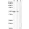 Carabin (TBC1D10C) Antibody