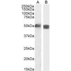 Carabin (TBC1D10C) Antibody