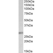 abx430776 (0.5 µg/ml) staining of Human Breast lysate (35 µg protein in RIPA buffer). Primary incubation was 1 hour. Detected by chemiluminescence.