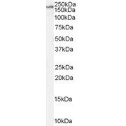 Western blot analysis of Rat Brain lysate (35 µg protein in RIPA buffer) using NMDAR2B antibody (2 µg/ml).